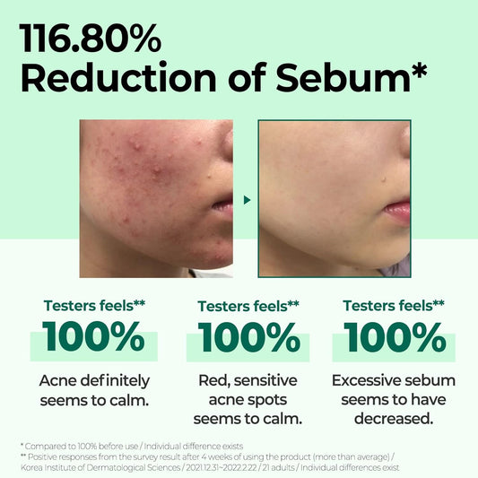 Some By Mi AHA BHA PHA 30 Days Miracle Toner 150ml - sebum reduction before and after - Korean skincare from 2M Beauty