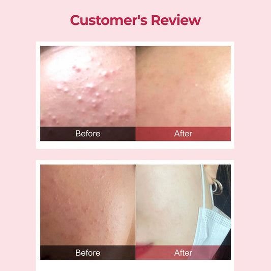 Numbuzin No.3 Skin Softening Serum 50ml - customer review before and after - Korean skincare from 2M Beauty