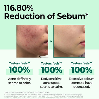 Some By Mi AHA BHA PHA 30 Days Miracle Toner 150ml - sebum reduction before and after - Korean skincare from 2M Beauty