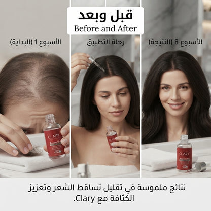 سيروم كلاري لتساقط الشعر 30 مل - 2M Beauty