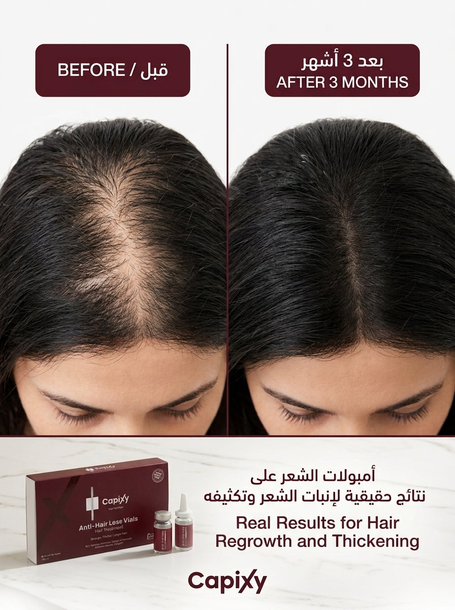 أمبولات كابيكسي لتكثيف الشعر 70 مل