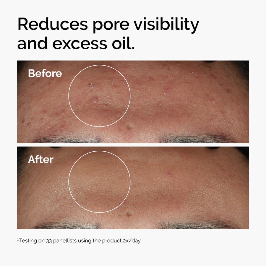سيروم نياسيناميد 10% مع زنك 1% 30 مل - 2M Beauty