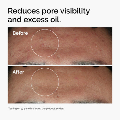 سيروم نياسيناميد 10% مع زنك 1% 30 مل - 2M Beauty